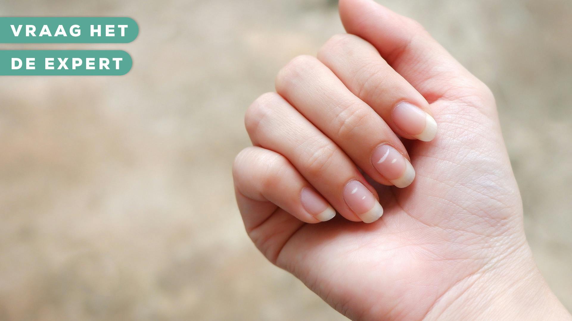 Witte Vlekjes Op Je Nagels? Dít Kunnen De Oorzaken Zijn